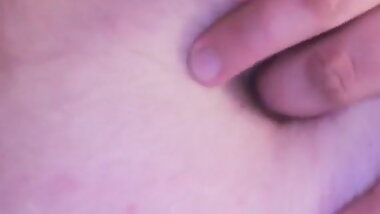 Fat gainer covered in stretchmarks, I'm getting so obese,